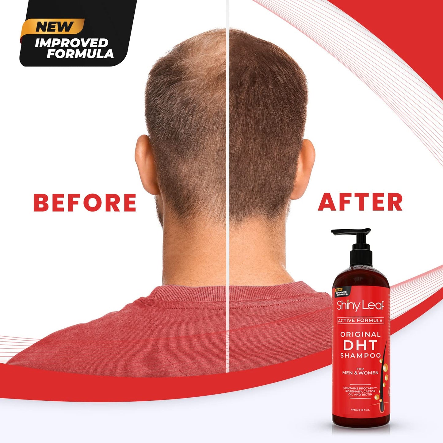 DHT Blocker Hair Loss Shampoo with Biotin — 16 oz