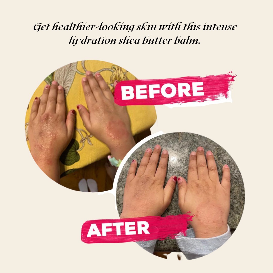 Ultra-Rich Body Balm for Very Dry Skin